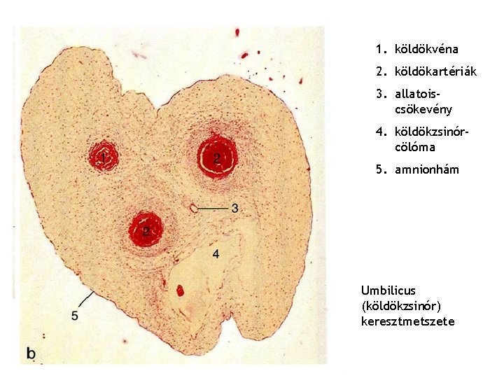 1. köldökvéna 2. köldökartériák 3. allatoiscsökevény 4. köldökzsinórcölóma 5. amnionhám Umbilicus (köldökzsinór) keresztmetszete 