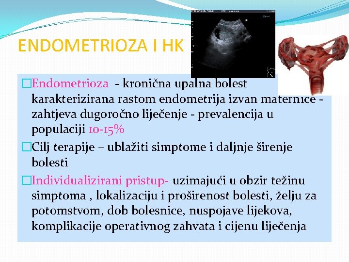 ENDOMETRIOZA I HK �Endometrioza - kronična upalna bolest karakterizirana rastom endometrija izvan maternice zahtjeva