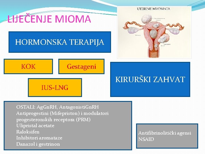 LIJEČENJE MIOMA HORMONSKA TERAPIJA KOK Gestageni IUS-LNG OSTALI: Ag. Gn. RH, Antagonisti. Gn. RH