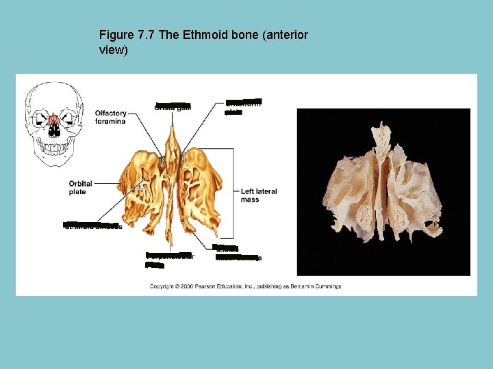 Figure 7. 7 The Ethmoid bone (anterior view) 