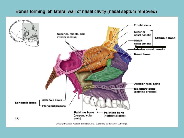 Bones forming left lateral wall of nasal cavity (nasal septum removed) 