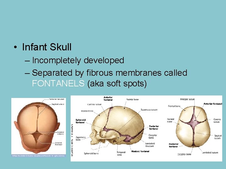  • Infant Skull – Incompletely developed – Separated by fibrous membranes called FONTANELS