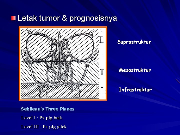 Letak tumor & prognosisnya Suprastruktur Mesostruktur Infrastruktur Sebileau’s Three Planes Level I : Px