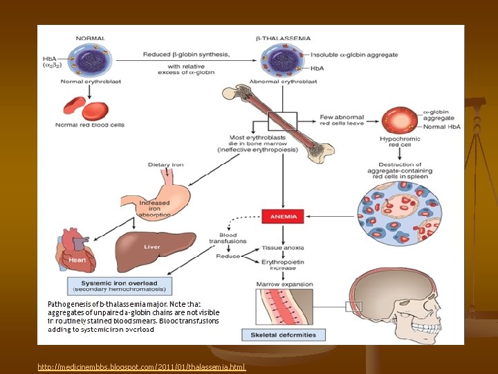 http: //medicinembbs. blogspot. com/2011/01/thalassemia. html 