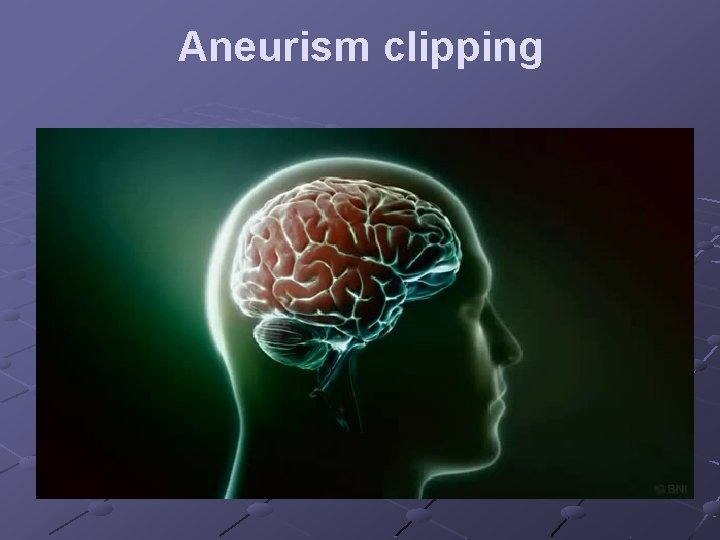 Aneurism clipping 