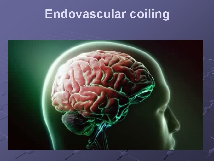 Endovascular coiling 