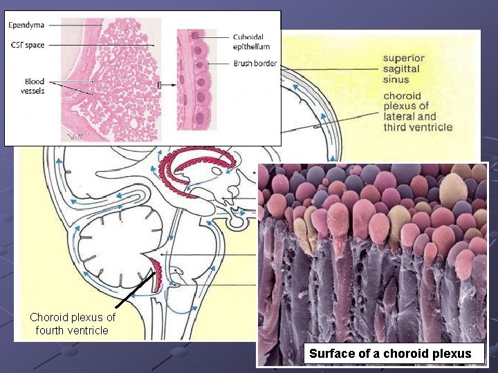 Choroid plexus of fourth ventricle Surface of a choroid plexus 