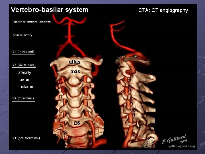 Vertebro-basilar system atlas laterally axis upward backward C 6 CTA: CT angiography 