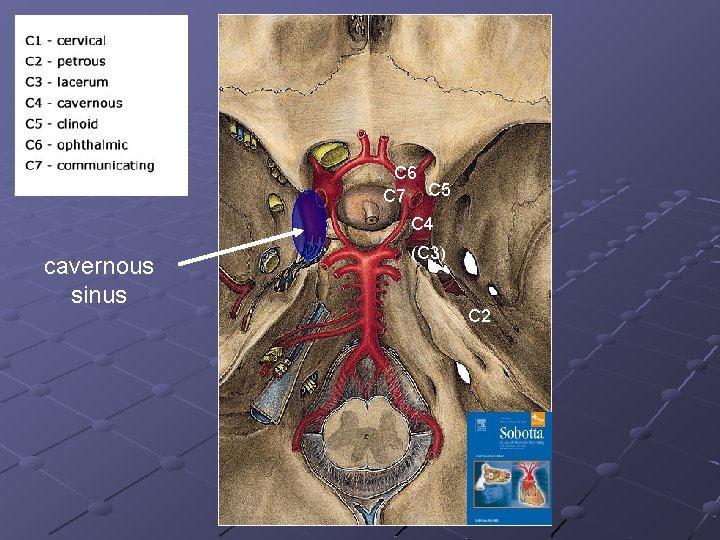 C 6 C 7 C 5 C 4 cavernous sinus (C 3) C 2