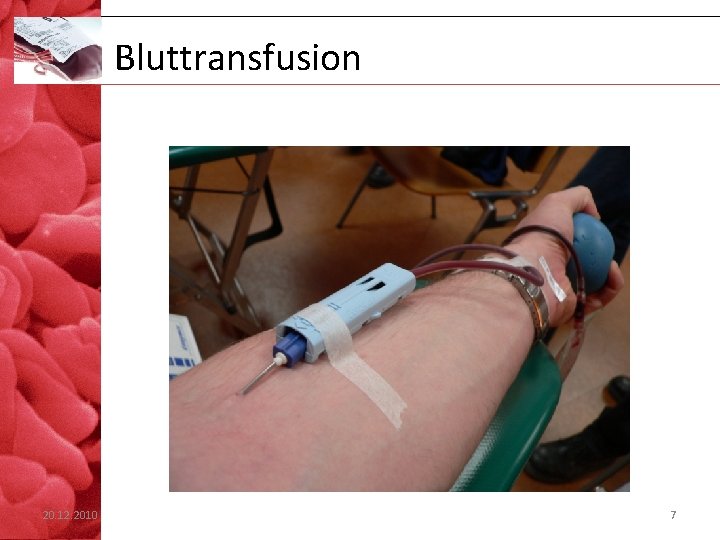 Bluttransfusion 20. 12. 2010 7 