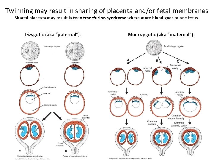 Twinning may result in sharing of placenta and/or fetal membranes Shared placenta may result