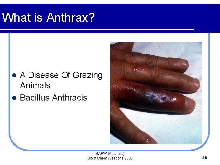 What is Anthrax? A Disease Of Grazing Animals l Bacillus Anthracis l MAPW (Australia)