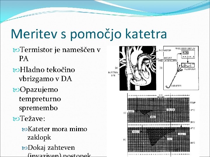 Meritev s pomočjo katetra Termistor je nameščen v PA Hladno tekočino vbrizgamo v DA