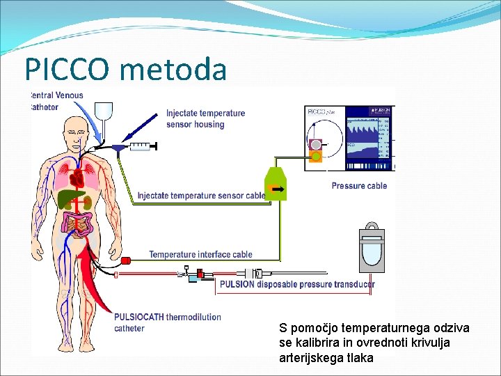 PICCO metoda S pomočjo temperaturnega odziva se kalibrira in ovrednoti krivulja arterijskega tlaka 