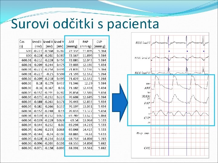 Surovi odčitki s pacienta 