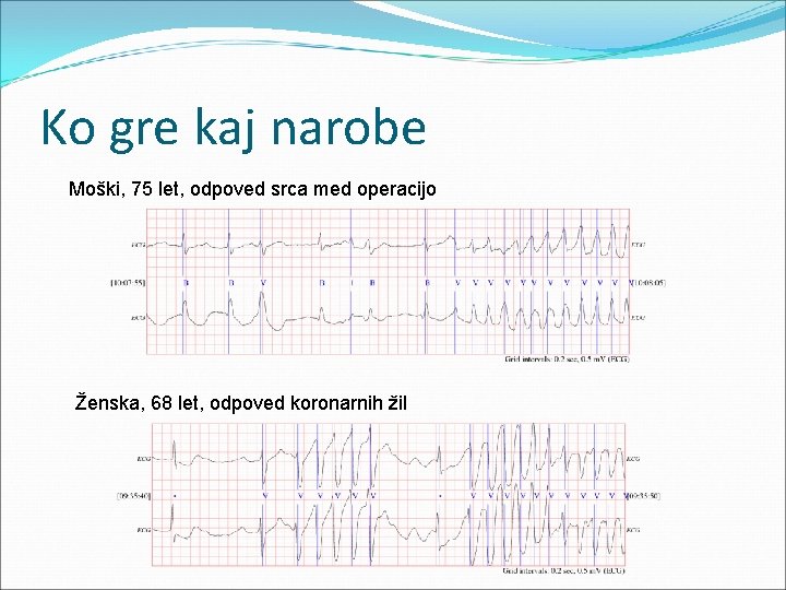 Ko gre kaj narobe Moški, 75 let, odpoved srca med operacijo Ženska, 68 let,