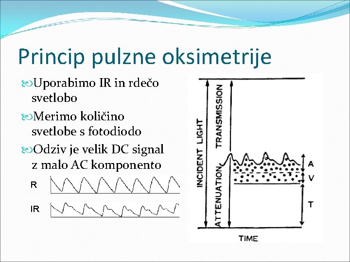 Princip pulzne oksimetrije Uporabimo IR in rdečo svetlobo Merimo količino svetlobe s fotodiodo Odziv