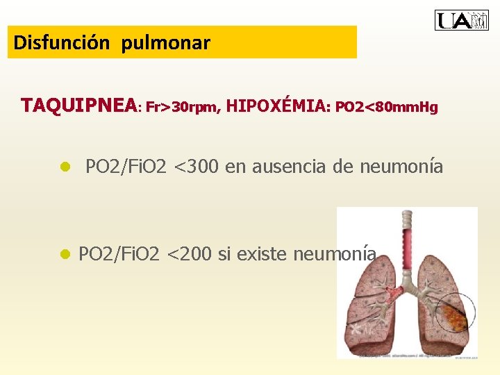 Disfunción pulmonar TAQUIPNEA: Fr>30 rpm, HIPOXÉMIA: PO 2<80 mm. Hg ● PO 2/Fi. O