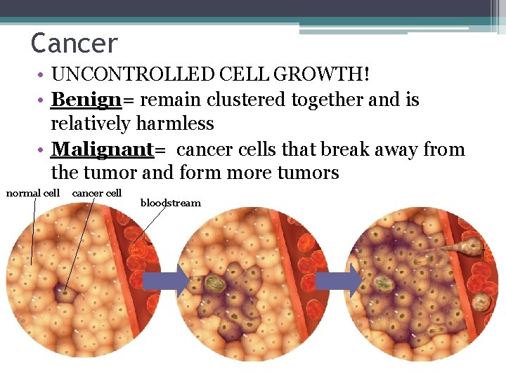 Cancer • UNCONTROLLED CELL GROWTH! • Benign= remain clustered together and is relatively harmless