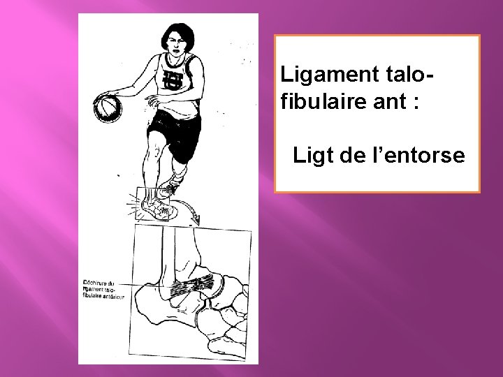 Ligament talofibulaire ant : Ligt de l’entorse 