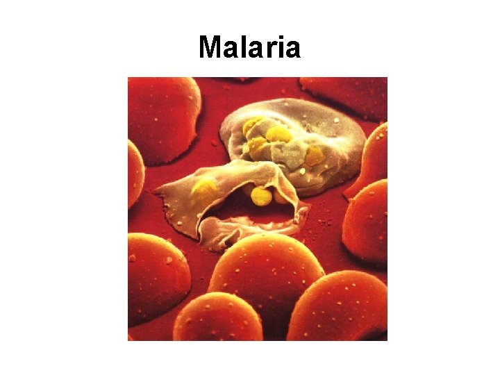 Malaria 