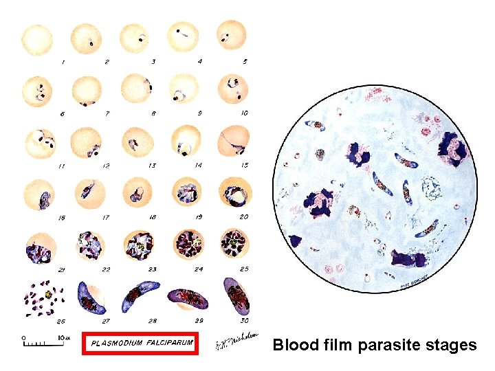 Blood film parasite stages 