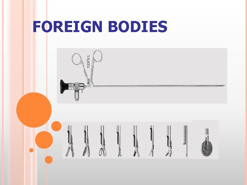 FOREIGN BODIES 
