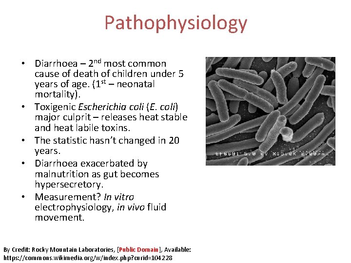 Pathophysiology • Diarrhoea – 2 nd most common cause of death of children under