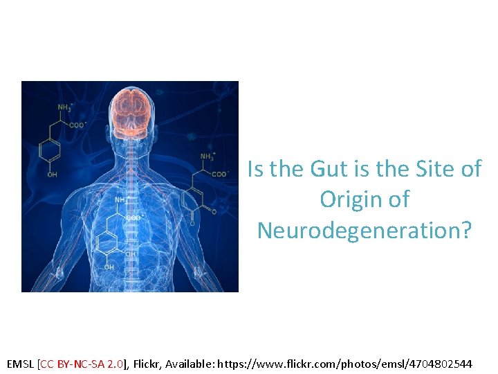 Is the Gut is the Site of Origin of Neurodegeneration? EMSL [CC BY‐NC‐SA 2.
