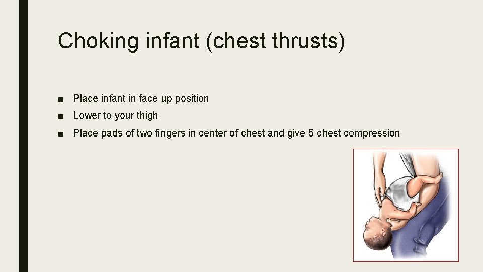 Choking infant (chest thrusts) ■ Place infant in face up position ■ Lower to