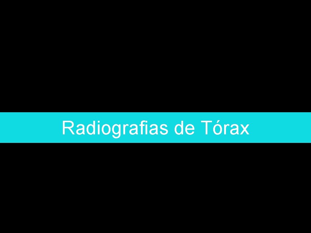 Radiografias de Tórax 