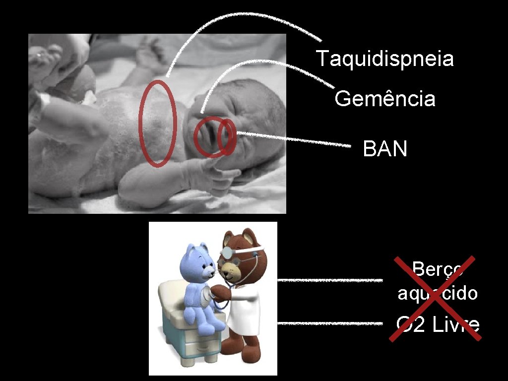 Taquidispneia Gemência BAN Berço aquecido O 2 Livre 