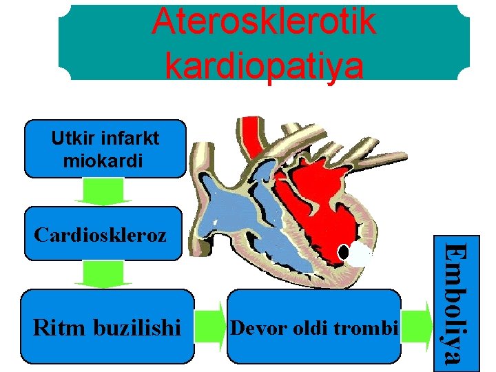 Aterosklerotik kardiopatiya Utkir infarkt miokardi Ritm buzilishi Devor oldi trombi Emboliya Cardioskleroz 