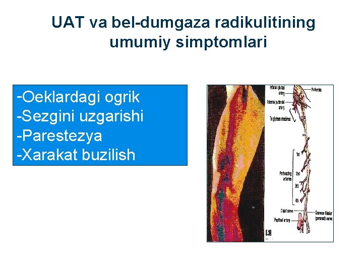 UAT va bel-dumgaza radikulitining umumiy simptomlari -Oeklardagi ogrik -Sezgini uzgarishi -Parestezya -Xarakat buzilish 