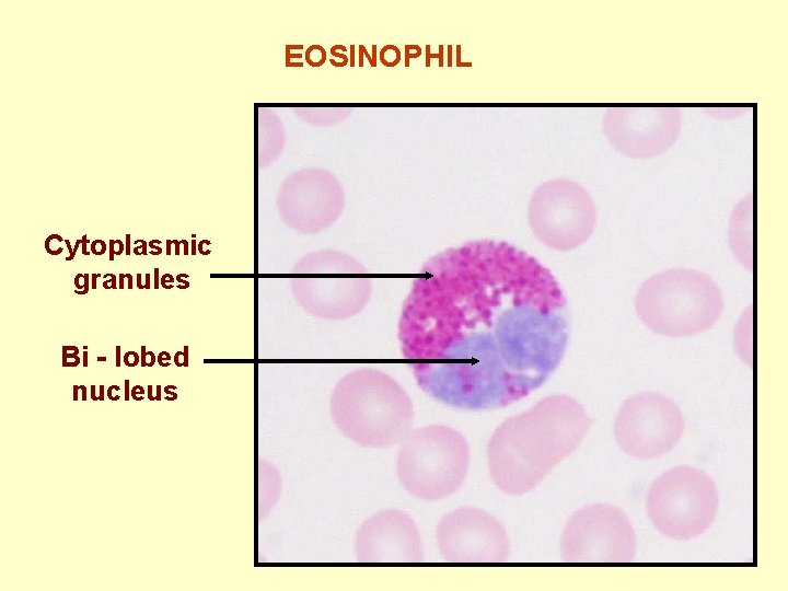 EOSINOPHIL Cytoplasmic granules Bi - lobed nucleus 