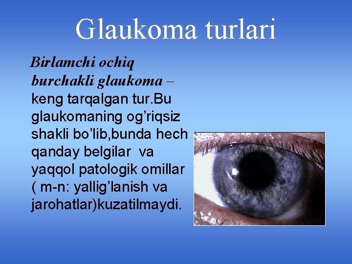 Glaukoma turlari Birlamchi ochiq burchakli glaukoma – keng tarqalgan tur. Bu glaukomaning og’riqsiz shakli