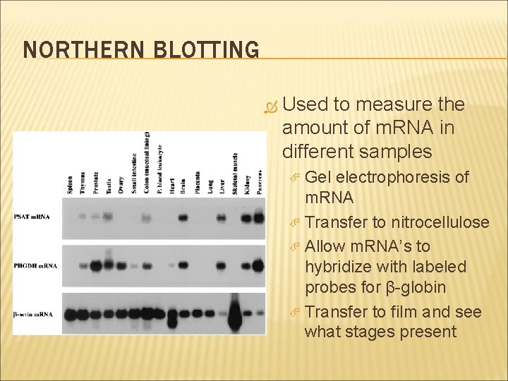 NORTHERN BLOTTING Used to measure the amount of m. RNA in different samples Gel