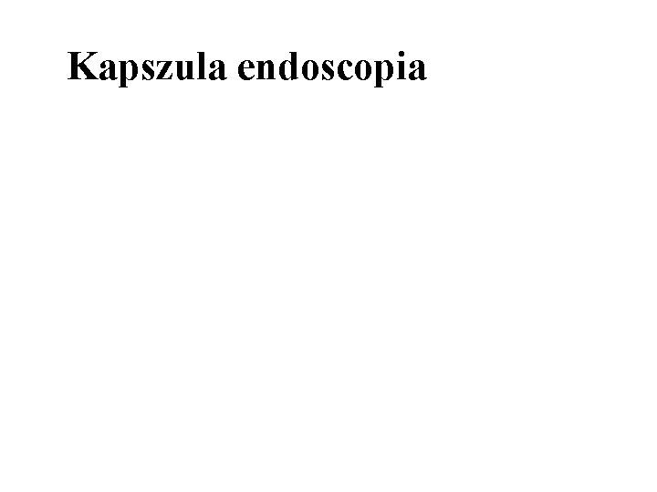 Kapszula endoscopia 