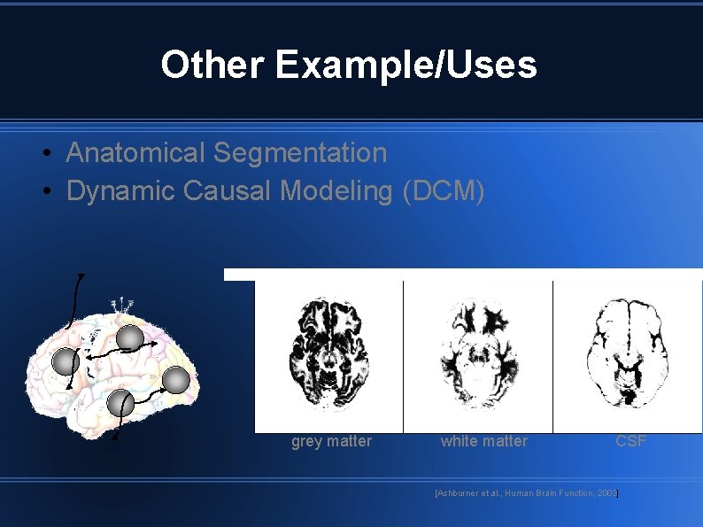 Other Example/Uses • Anatomical Segmentation • Dynamic Causal Modeling (DCM) grey matter white matter