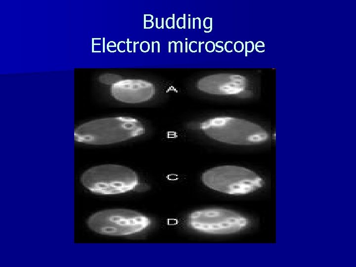 Budding Electron microscope 