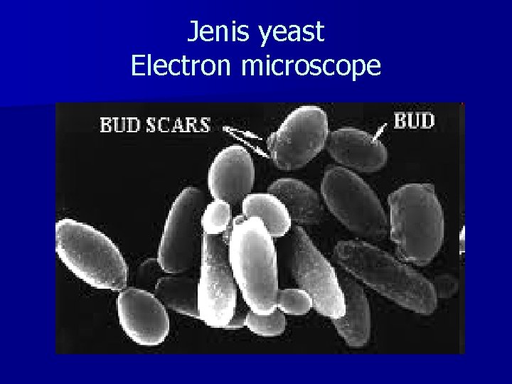 Jenis yeast Electron microscope 