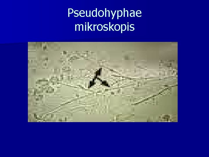 Pseudohyphae mikroskopis 