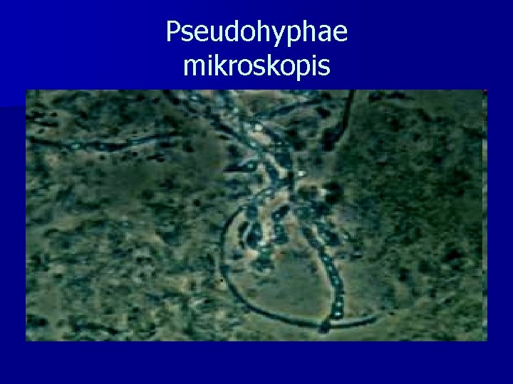 Pseudohyphae mikroskopis 