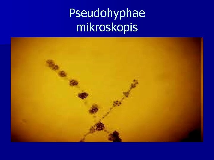 Pseudohyphae mikroskopis 