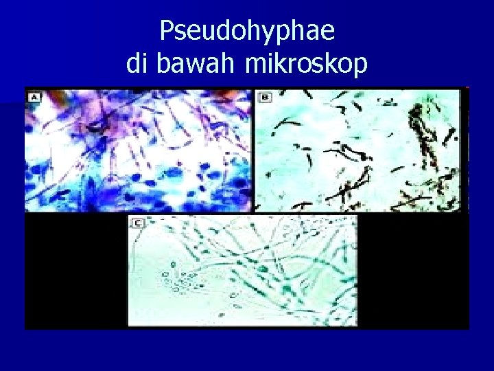 Pseudohyphae di bawah mikroskop 