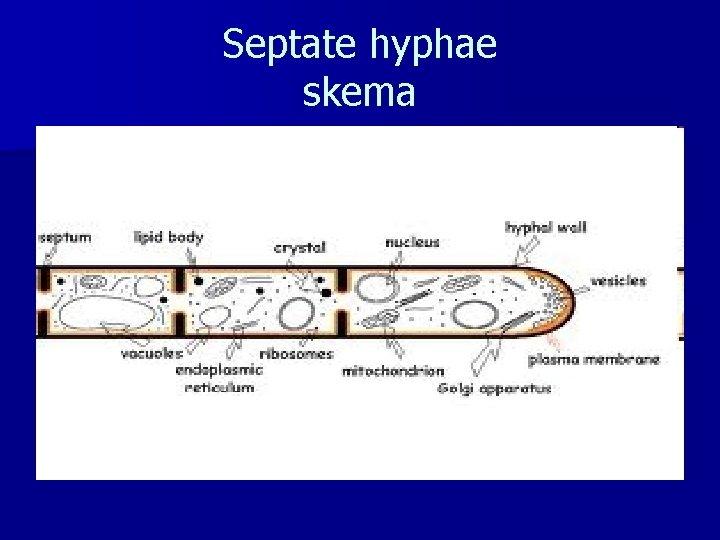 Septate hyphae skema 