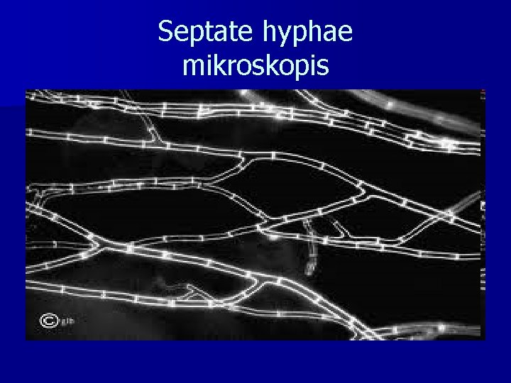 Septate hyphae mikroskopis 