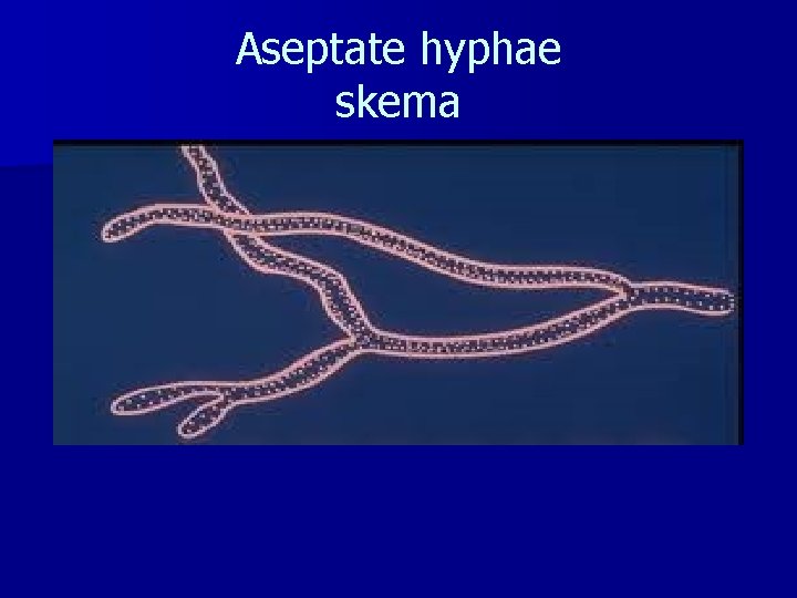 Aseptate hyphae skema 