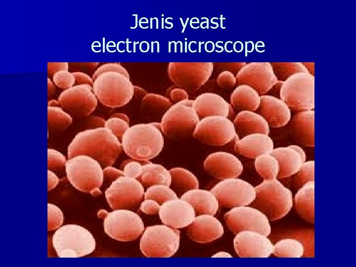 Jenis yeast electron microscope 