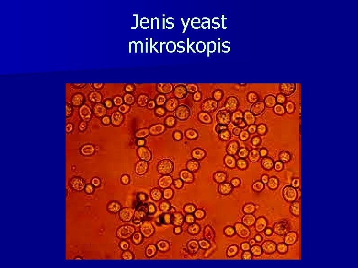 Jenis yeast mikroskopis 